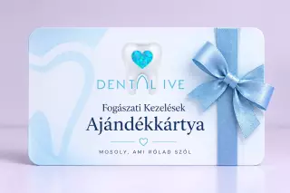 Fogászati Kezelések Ajándékkártya